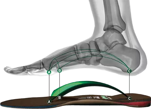 Custom orthotics with foot above orthotic pad